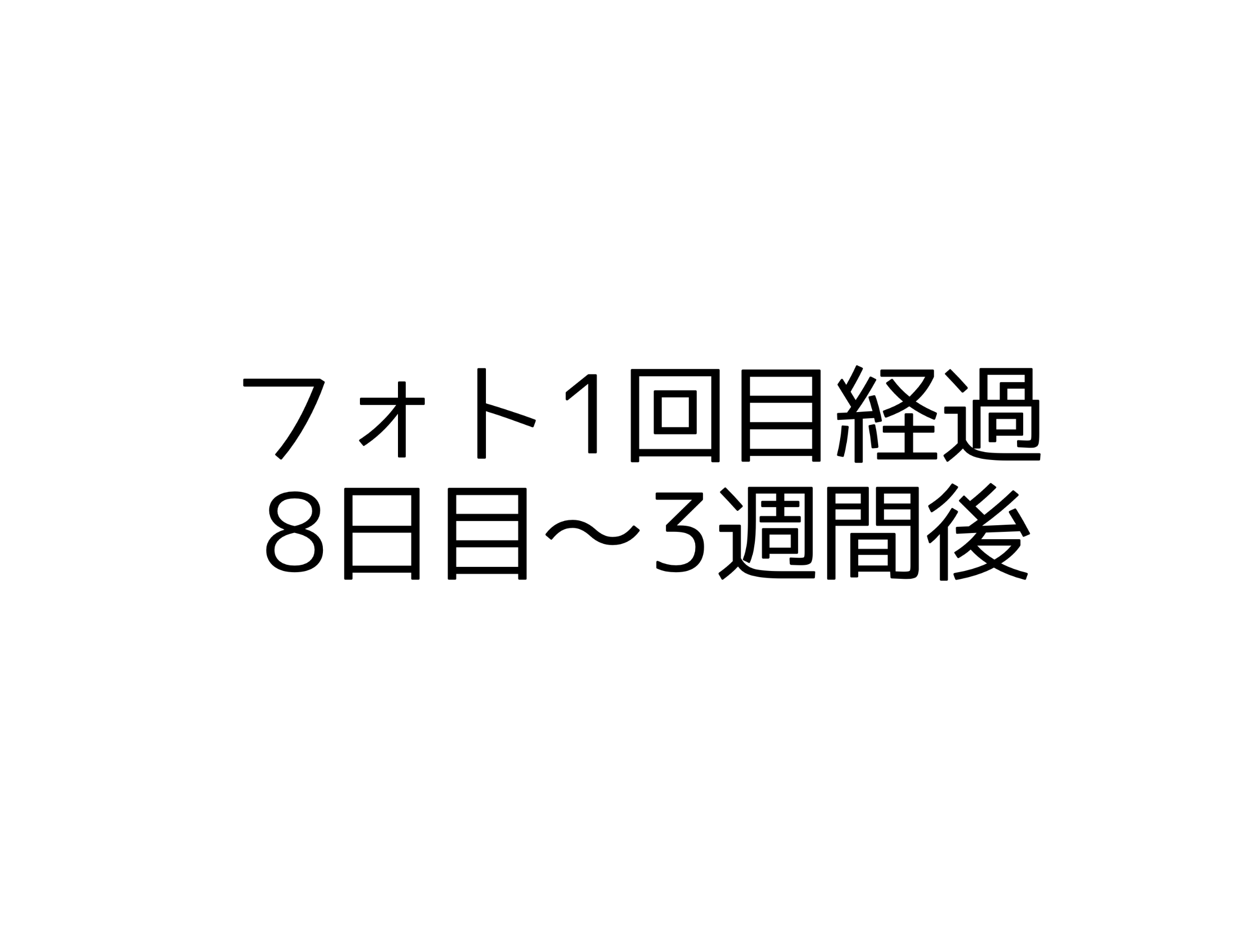 フォト１回目経過８日目〜３週間後