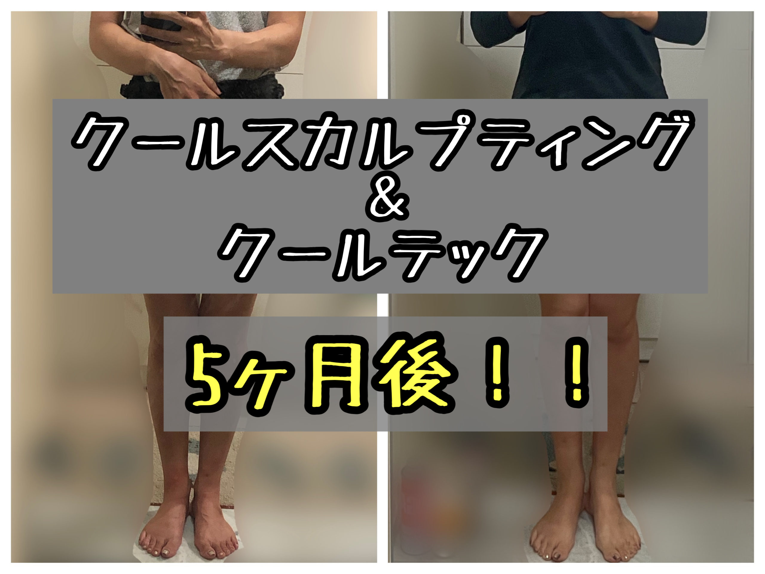 クールスカルプティングとクールテックその後は クールテック推しの4つの理由 メメコメモ クールスカルプティングとクールテックその後は クールテック推しの4つの理由 メメコメモ