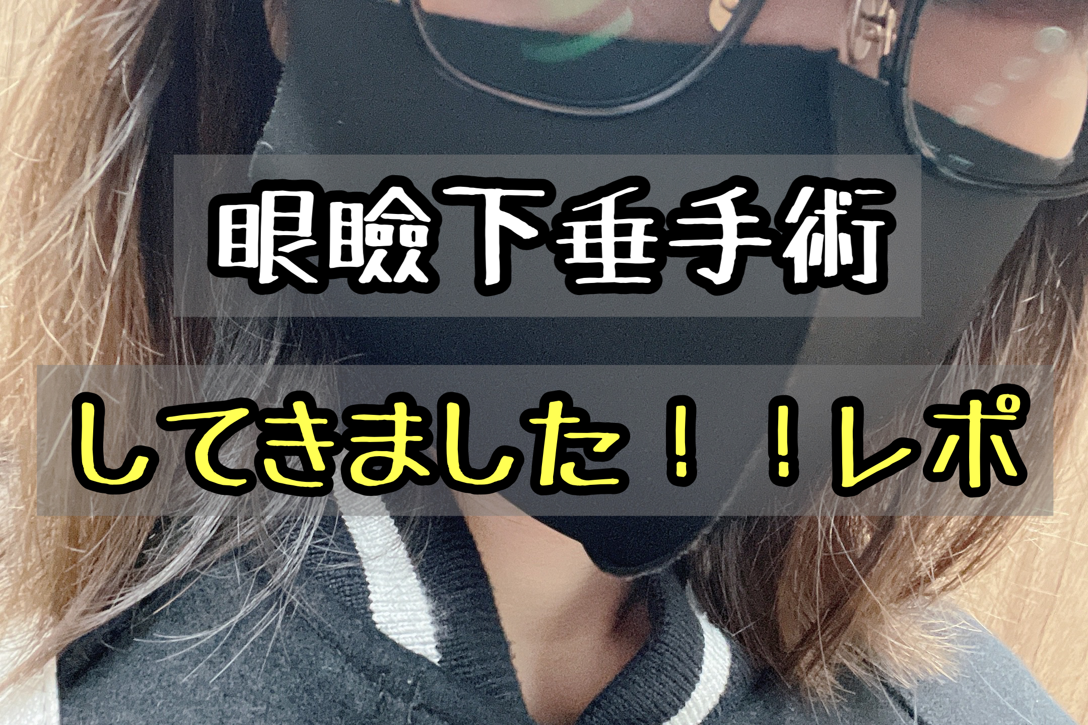 眼瞼下垂とは 軽度でも手術で二重になれる 実際にやってきたブログ メメコメモ 眼瞼下垂とは 軽度でも手術で二重になれる 実際にやってきたブログ メメコメモ