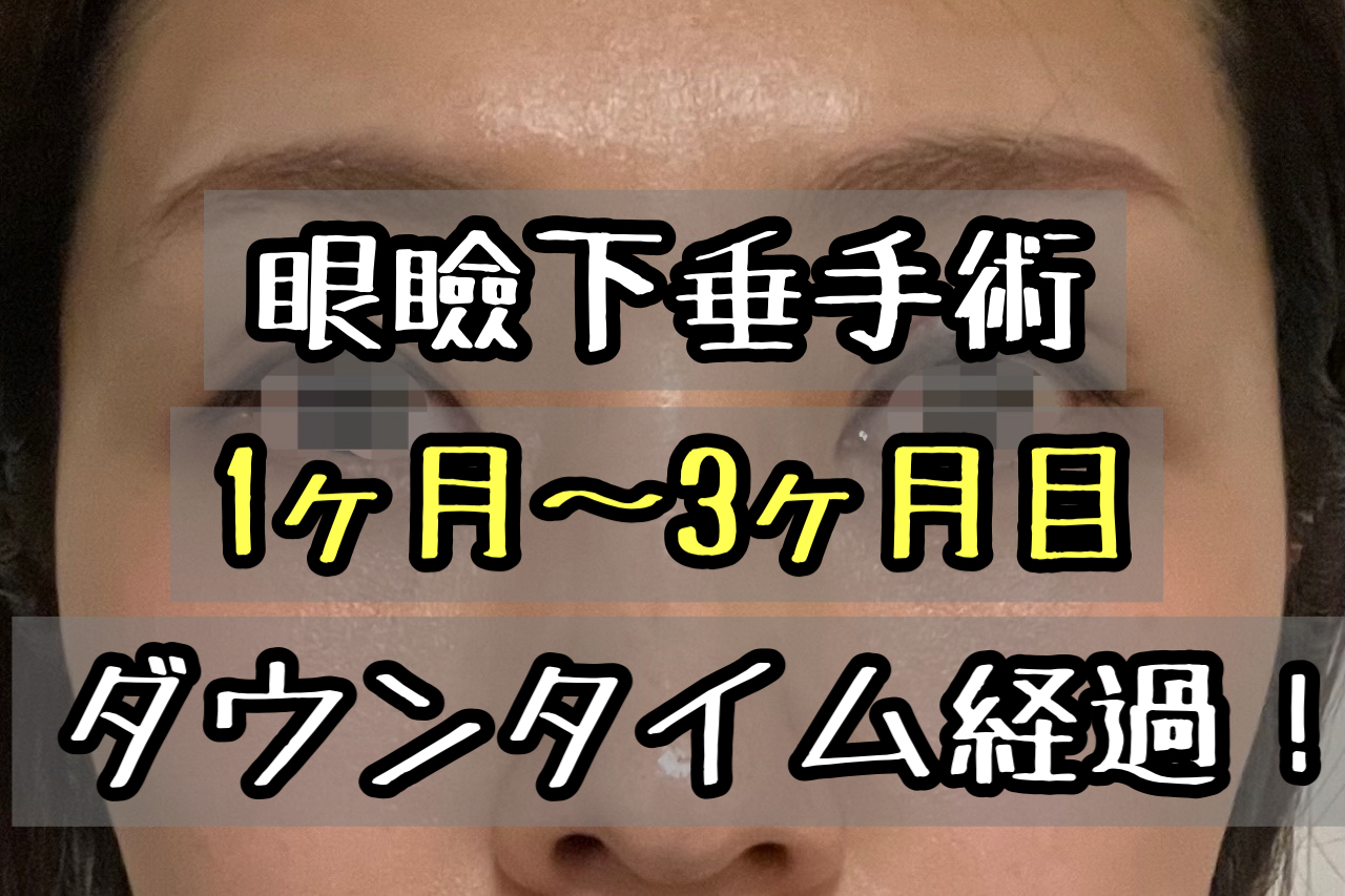 眼瞼下垂手術のダウンタイム経過ブログ 3ヶ月経過して跡はどうなった 画像付きでレポします メメコメモ 眼瞼下垂手術のダウンタイム経過ブログ 3ヶ月経過して跡はどうなった 画像付きでレポします メメコメモ